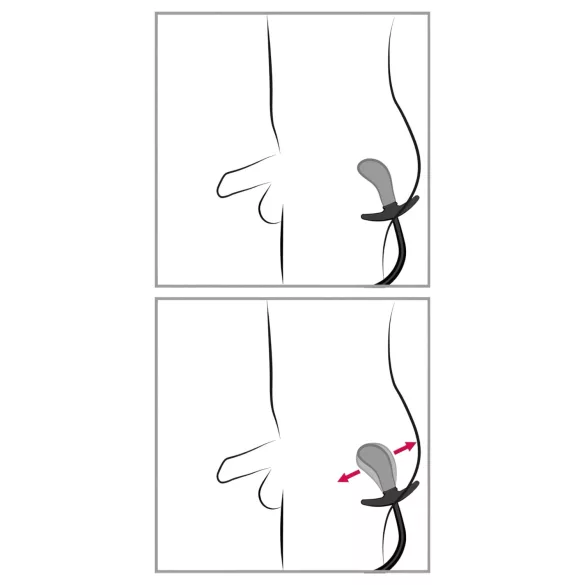 You2Toys - Black Inflatable Beaded Anal Plug