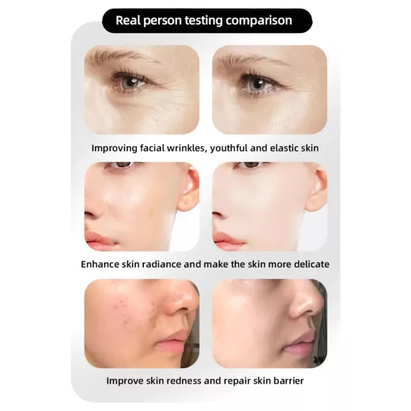 Photon Skin Rejuvenating LED Face Mask (4 Light Therapy Modes)